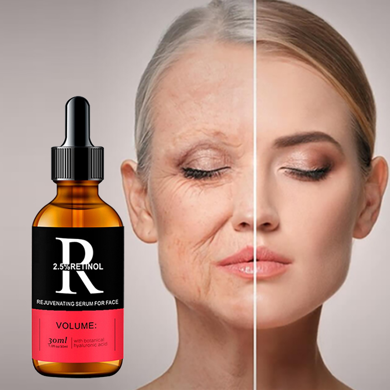 Azelaic Acid Serum - Gezicht Serum Huidverzorging Vitamine C Hyaluronzuur