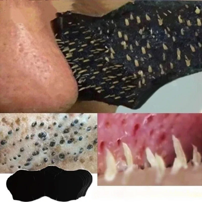 10 PC/50 PC 100 PC mee-eter ne - Charcoal Pore Strip recensie en prijs
