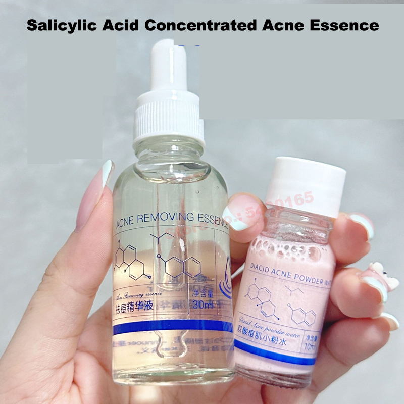 Salicylzuuroplossing Essentie  - Azelaic Acid Serum recensie en prijs