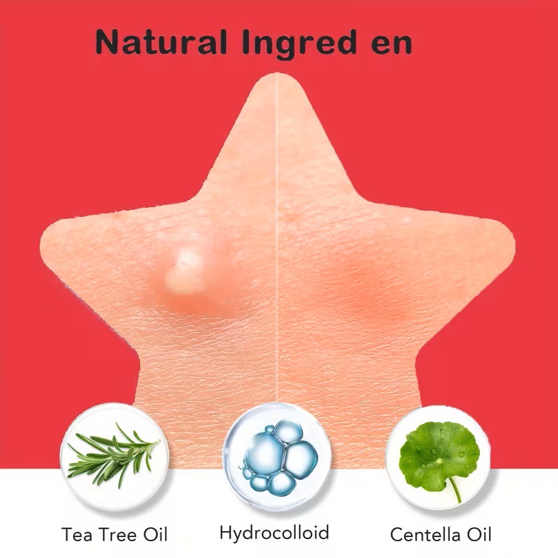 200/400 stuks Acnepleisters vo - Skincare Moisturizer recensie en prijs