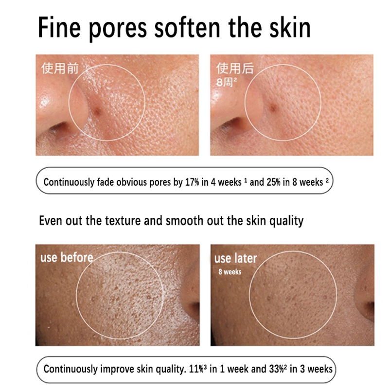 Aloe 2% + NAG 2% Oplossing Ser - Azelaic Acid Serum recensie en prijs