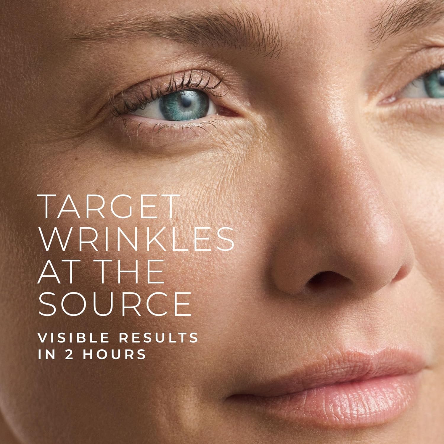 Hyaluronzuur Retinol Microneed - Skincare Moisturizer recensie en prijs